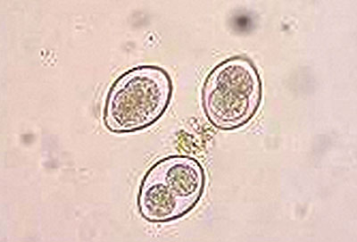 Oocysts